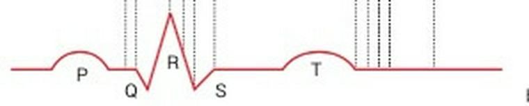 正常心電図