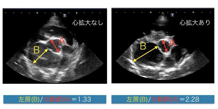 心臓の超音波画像