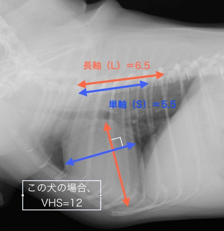 胸部レントゲン画像